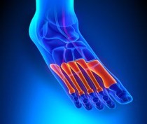 Pain In The Front Of Your Foot Coastal Podiatry