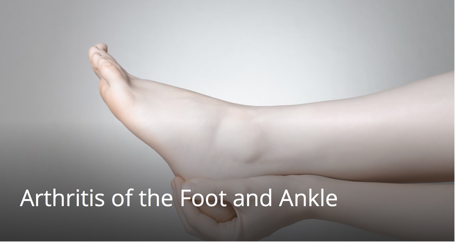 Arthritis of the Foot and Ankle - Coastal Podiatry